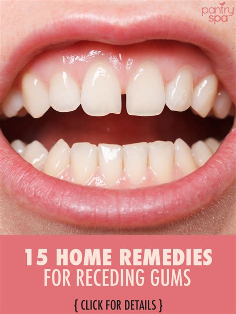 How To Reduce Gap Between Teeth Naturally At Home Zaczarowany Czarny