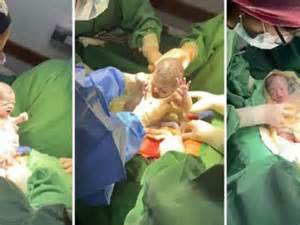 Nacieron trigemelas en Salta, un extraño fenómeno que se produce cada