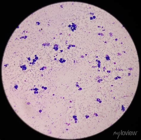 Microscopic View Of Blood Smear Hematological Stained Slide Posters