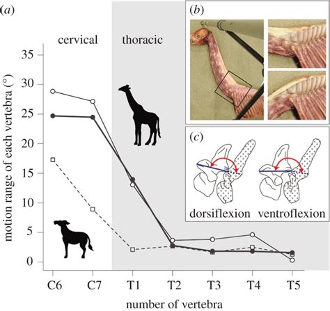 Functional Cervicothoracic Boundary Modified By Anatomical Shifts In