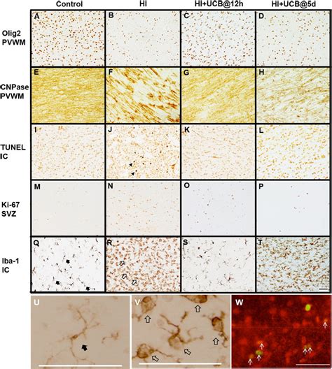 Photomicrograph Images Showing Olig2 A D And CNPase E H Staining In