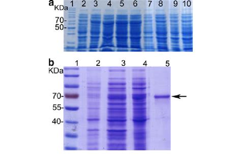 Sdspage Analysis Of The Control Negative Bacteria E Coli Bl With