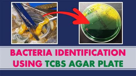 Bacteria Identification Using Tcbs Agar Plate We Show You The Results