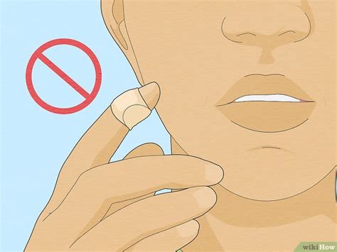 How to Treat Whitlow: Medical Treatments & Home Remedies