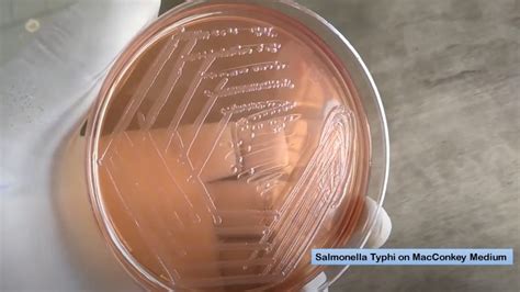 Atlas Of Bacteria Introduction And List Of Bacteria And Related Features