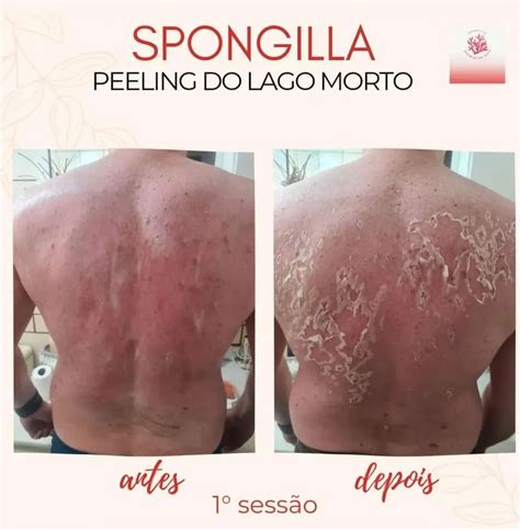 Curso De Peeling Spongilla By M Nnica Hirsh Curso De Peeling