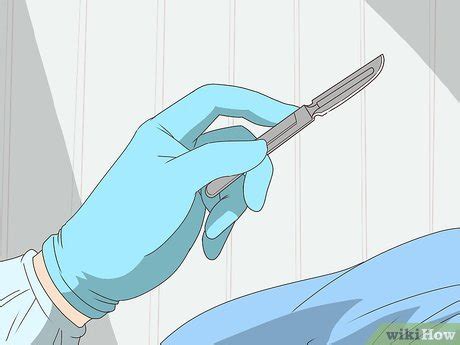 3 Ways to Cure Nasal Polyps - wikiHow