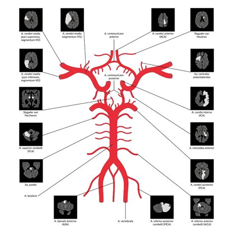 Cirkel Van Willis Klinische Anatomie Geneesleer