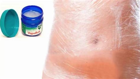 15 Unlikely Uses For Vicks VapoRub That You Didn't Know Before ...