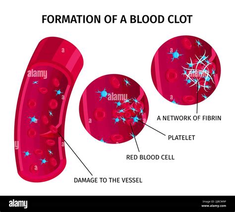 Células sanguíneas Trombo coagulación infografía educativa gráfica