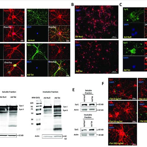 Hiv 1 Tat Promotes Alterations In Synaptic Vesicle Proteins