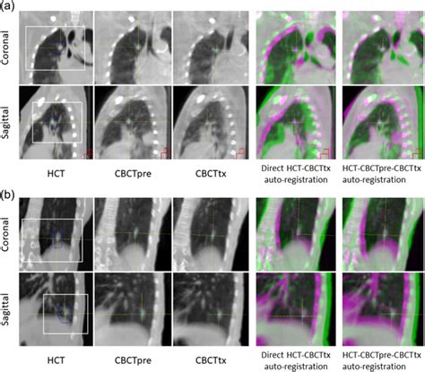 Images Of The Reference Helical Ct Hct Cone Beam Computerized