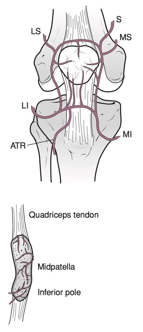 Patella Sleeve Fracture - Pediatrics - Orthobullets