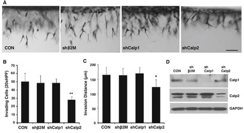 Calpain Knockdown Significantly Reduced EC Invasion ECs Were Not