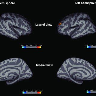 Freesurfer Whole Brain Vertex Wise Analysis Of Cortical Surface Area