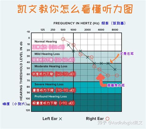 如何看懂听力检查报告！快来看看吧～ 知乎