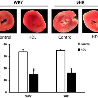 Effects of HDL treatment on plasma cholesterol and hepatic SR-BI ...