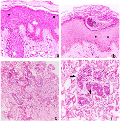 e Histopathological examination H&E (under magnification 40X) reveals ...