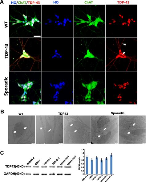 TDP43 Expression And Aggregation In IPSC Derived Neurons A