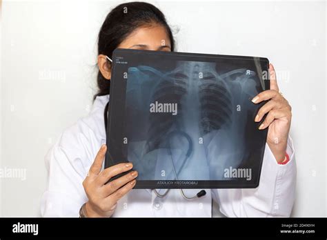 Radiografia Toracica Immagini E Fotografie Stock Ad Alta Risoluzione