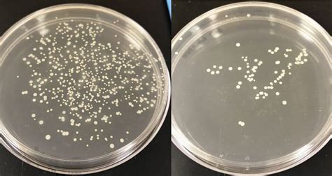 Bacterial Growth On Agar Plates