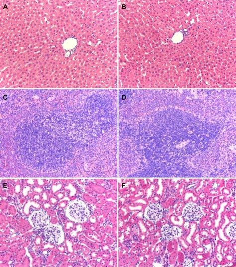 Hematoxylin And Eosin Staining Of Liver Spleen And Kidney From Rats