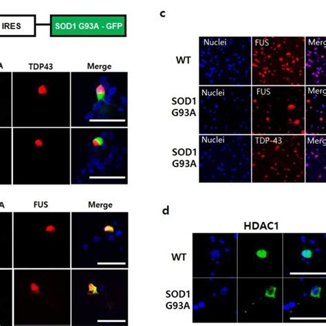 Sod Mutation Mediated Amyotrophic Lateral Sclerosis Als Pathogenic