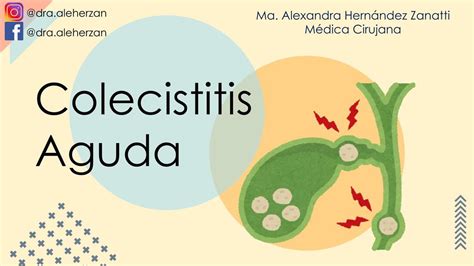 Colecistitis Apendicitis Aguda Dra Ale Herzan Udocz