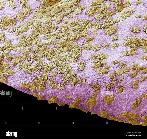 Fimbriae Of A Fallopian Tube Coloured Scanning Electron Micrograph Sem Fimbriae Are The