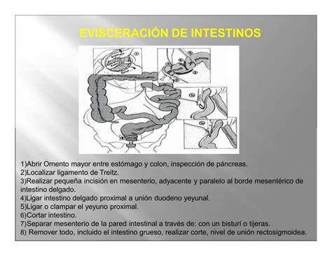 Autopsia Por Diferentes Tecnicas Pptx Descarga Gratuita