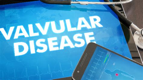 What Causes Valvular Heart Disease Symptoms Treatment Healthtrip