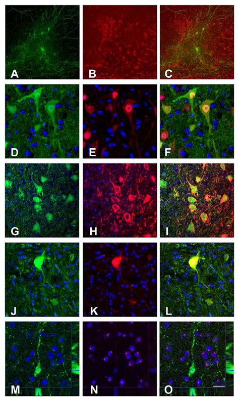 Double Immunofluorescence Staining And Three Dimensional Confocal