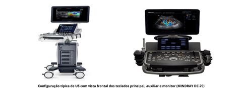 Equipamento De Ultrassonografia E Fun Es Principais Medsystem