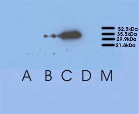 3. Recombinant human kallikrein 4 detected on western blots | Download ...