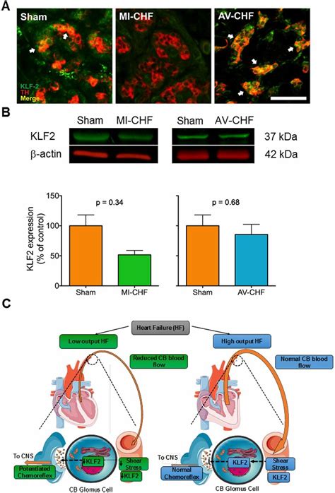 Krüppel like factor 2 KLF2 expression is reduced in myocardial