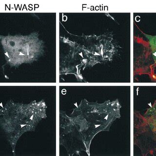 In Vitro Reconstitution Of Actin Assembly On E Coli VirG And