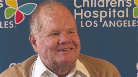 First Man to Receive Kidney Transplant at LA Hospital Returns After 50 ...