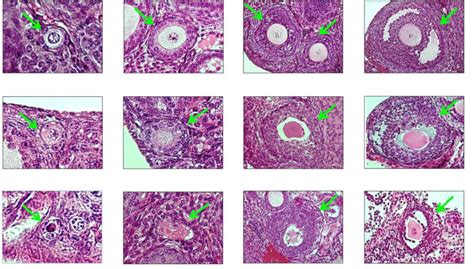 Representative Histologic Images Of Mouse Ovarian Follicles Mayer S