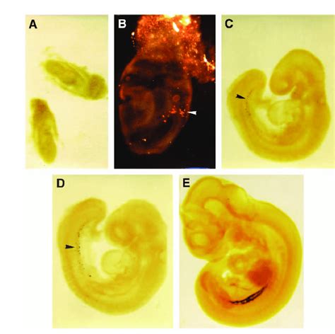 Specific Expression Of Oct 4 LacZ Transgenes In The Germ Cell Lineage