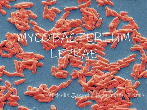 MYCOBACTERIUM leprae | Lepra | Mycobacterium leprae | uDocz