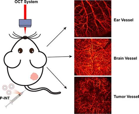 Natural Fat Nanoemulsions For Enhanced Optical Coherence Tomography