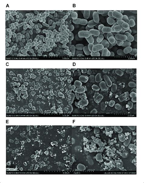 Sem Images Of E Coli O H Cells Untreated Bacteria A B