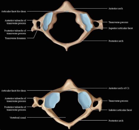 Craniovertebral Junction Radiology Key