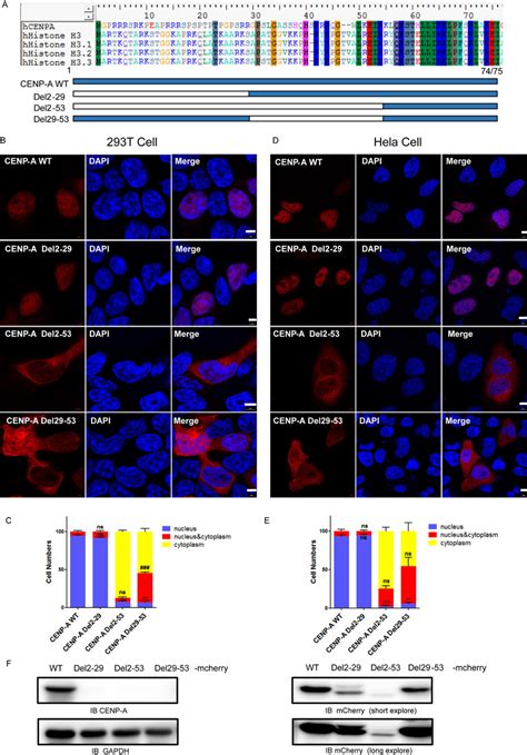 The Nuclear Localization Of CENP A Requires Its Amino Terminus A