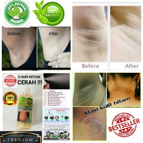 Ubat Ketiak Organic Natural The Alami 60ml Spray Cerah Pemutih Badan