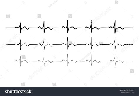 Vector Black Normal Heart Rhythm Set Electrocardiogram Ecg Ekg Signal