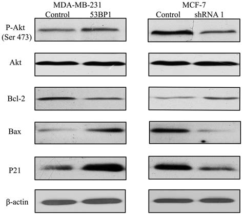 53BP1 Sensitizes 5 Fu Induced Apoptosis In Breast Cancer Cells The