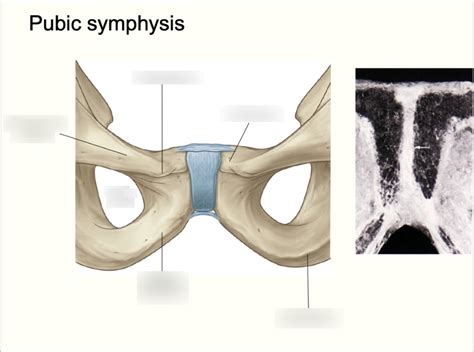 Pubic Symphysis Diagram Quizlet