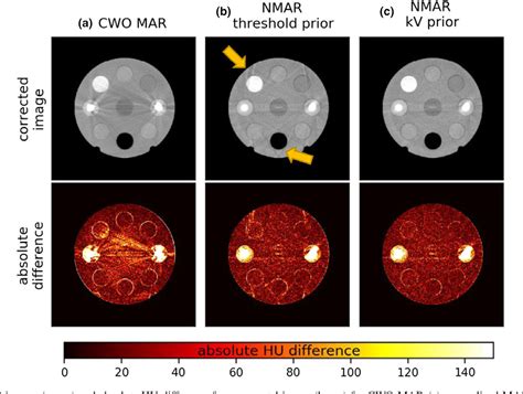 Figure From Investigation Of Combined Kv Mv Cbct Imaging With A High