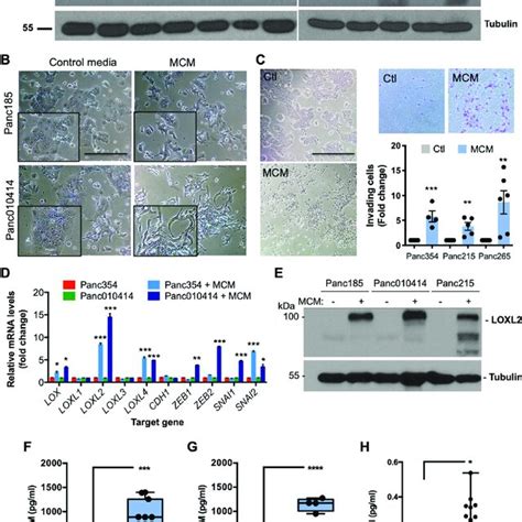 Macrophages Induce Loxl And Emt In Pdx Derived Pdac Cells Via Osm A